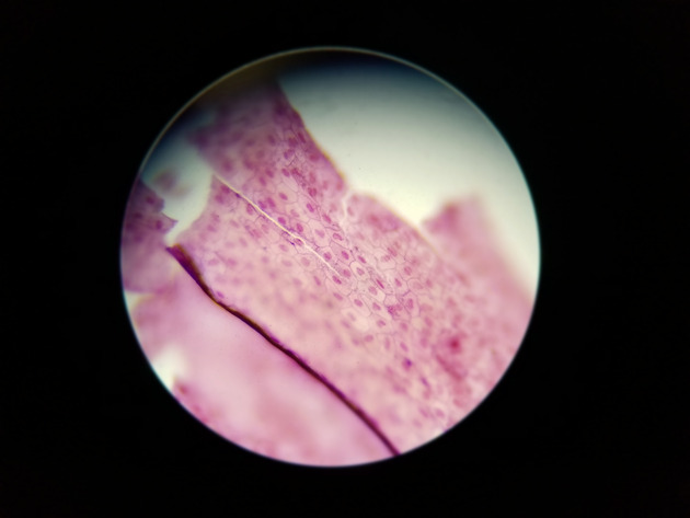 Simple Squamous Epithelium Slides - Simple Squamous Epithelium 06 100X